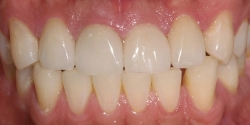 After image