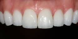After image