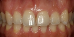 Before image