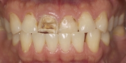 Before image
