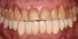 Before image