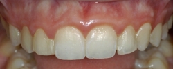 Before image