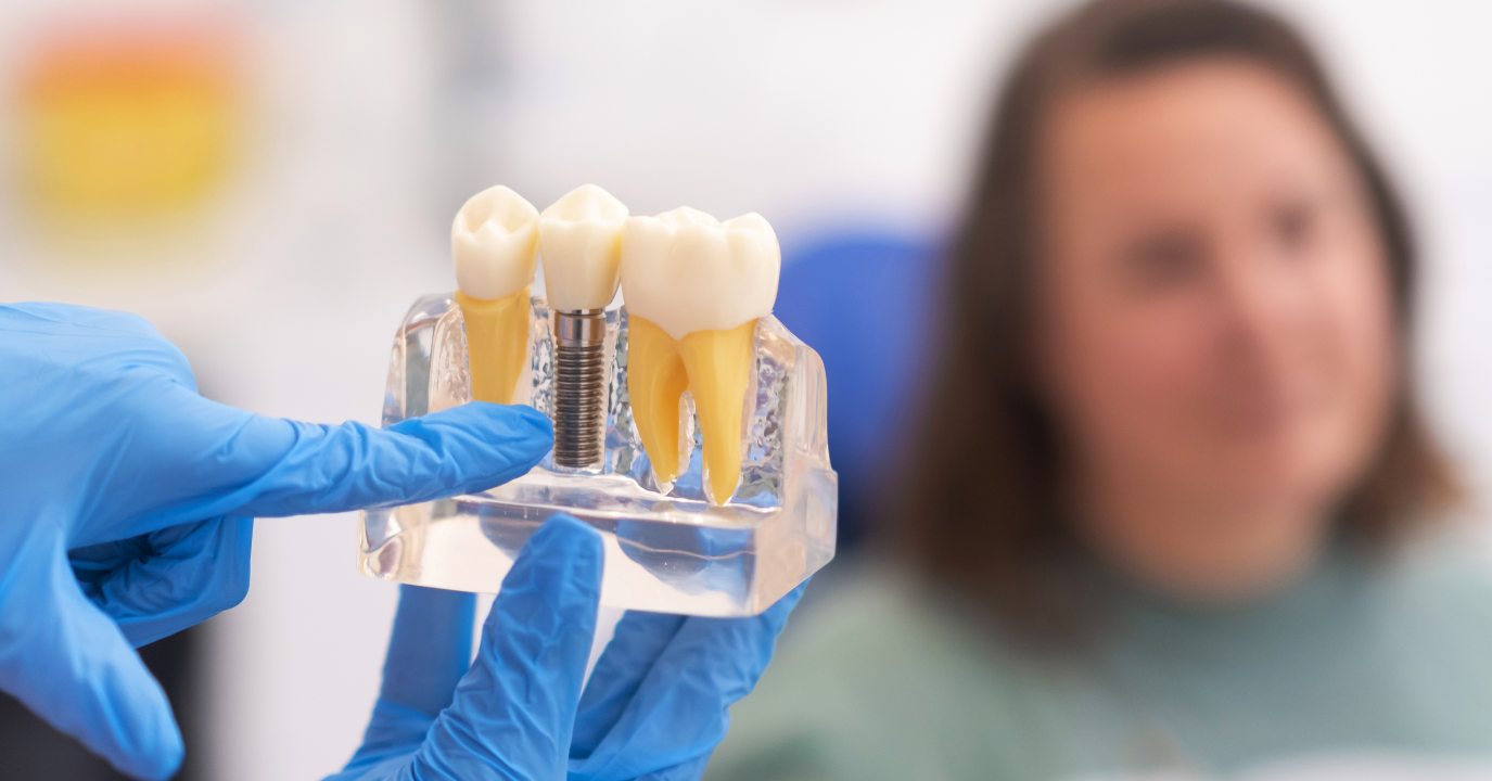 爆買いしたくなる The Ultimate Know to Need You What Implants: Dental to Guide 健康・医学